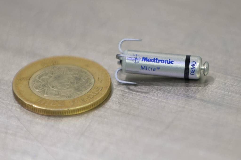 Beneficia ISSSTE a cinco pacientes con colocación de marcapasos sin&nbsp;cables